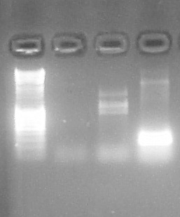 ParisSaclay 22.07.15 ARN tige boucle PCR.jpg