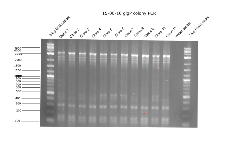 Aachen 15-06-16 glgP colony PCR.png